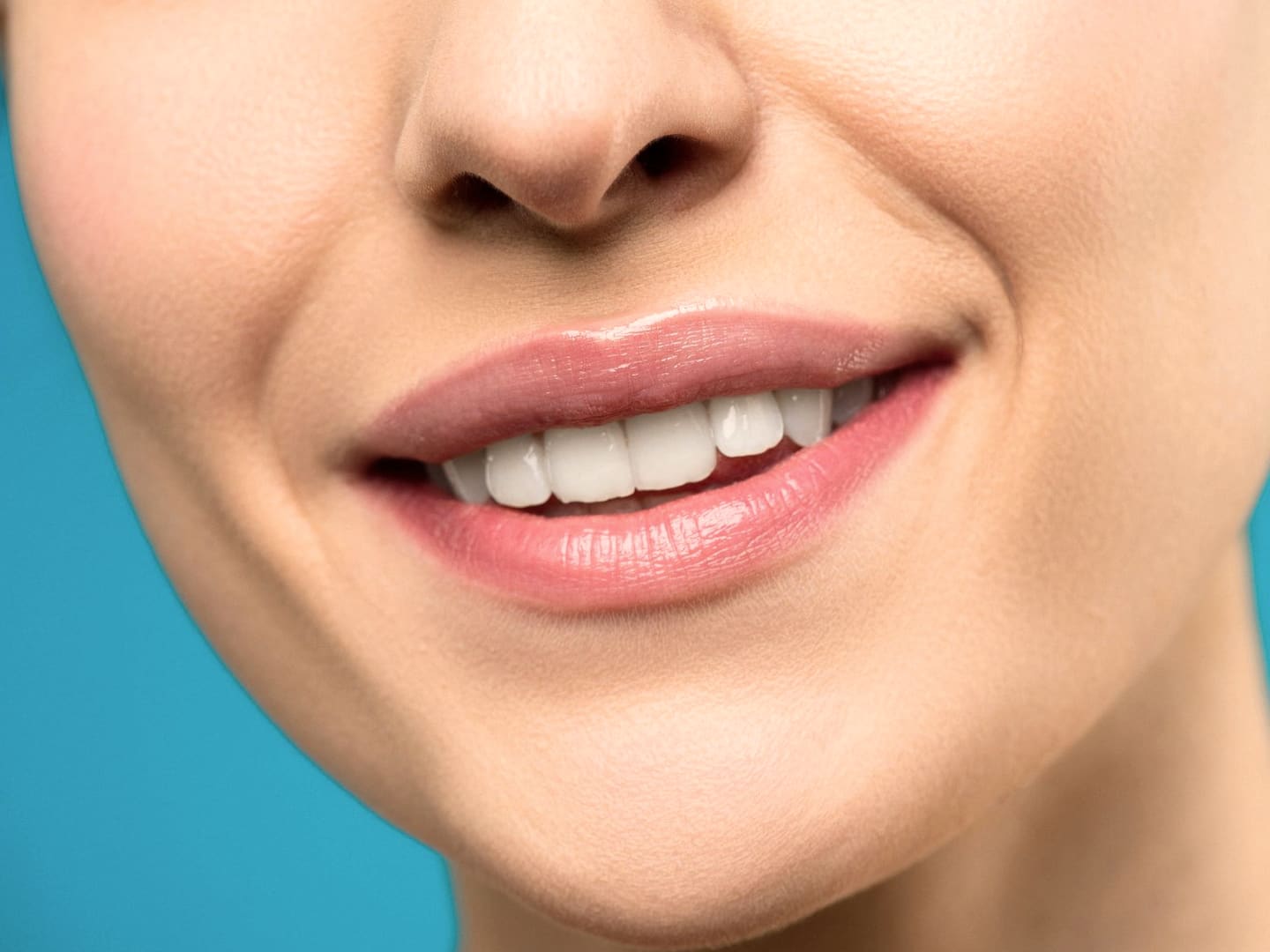 Composite bonding at Shirland Dental Maida Vale