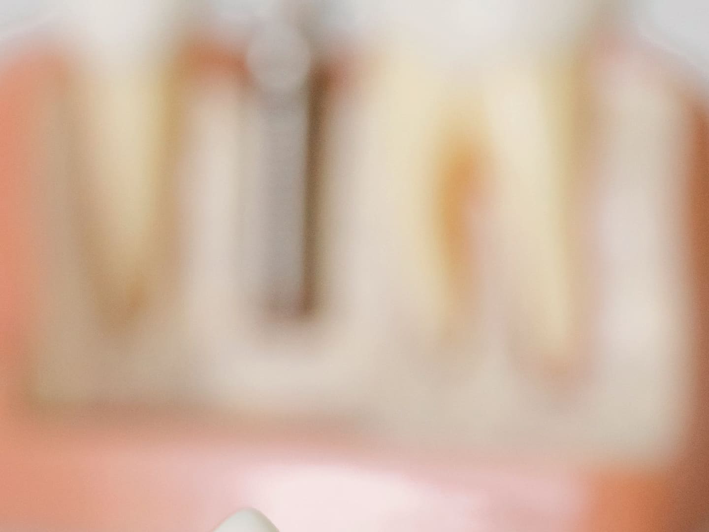 Ceramic crown being fitted on a dental model